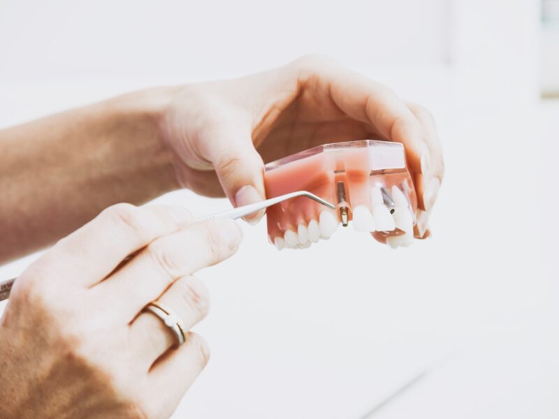 dentures being cleaned