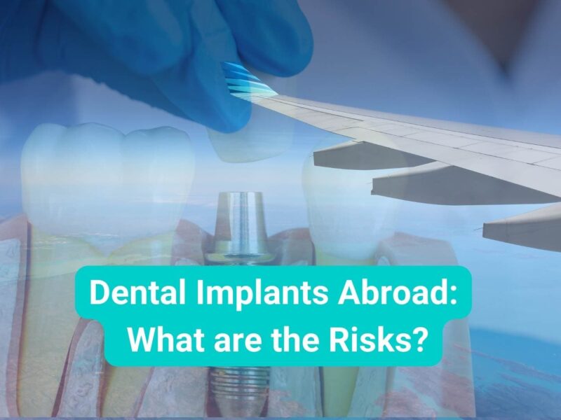 dental implants abroad what are the risks